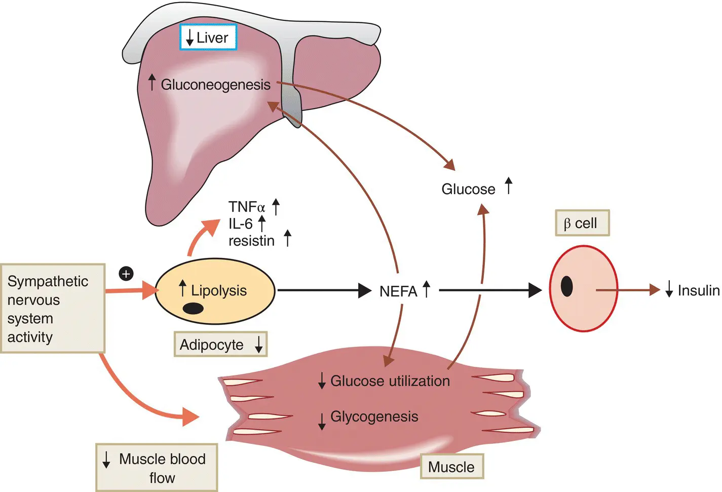 Figure 714 Mechanisms of insulin resistance in type 2 diabetes Inflammation - фото 76