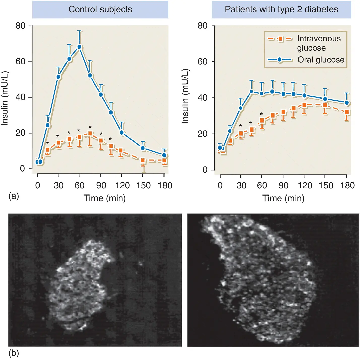 Figure 514 a The incretin effect is greatly diminished in patients with type - фото 46
