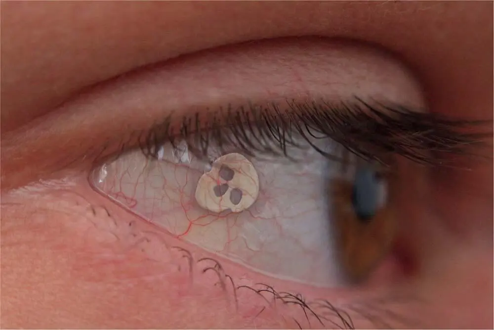 Extreme body modifications Tonguesplitting implants earreshaping beading - фото 18
