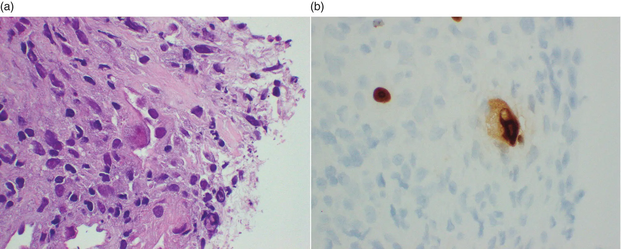 Figure 28 Highmagnification evaluation of Figure 27demonstrated a - фото 25