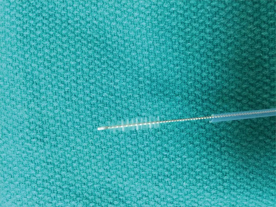 Figure 17 Endoscopic cytology brush Note the abrasive brush extended beyond - фото 8
