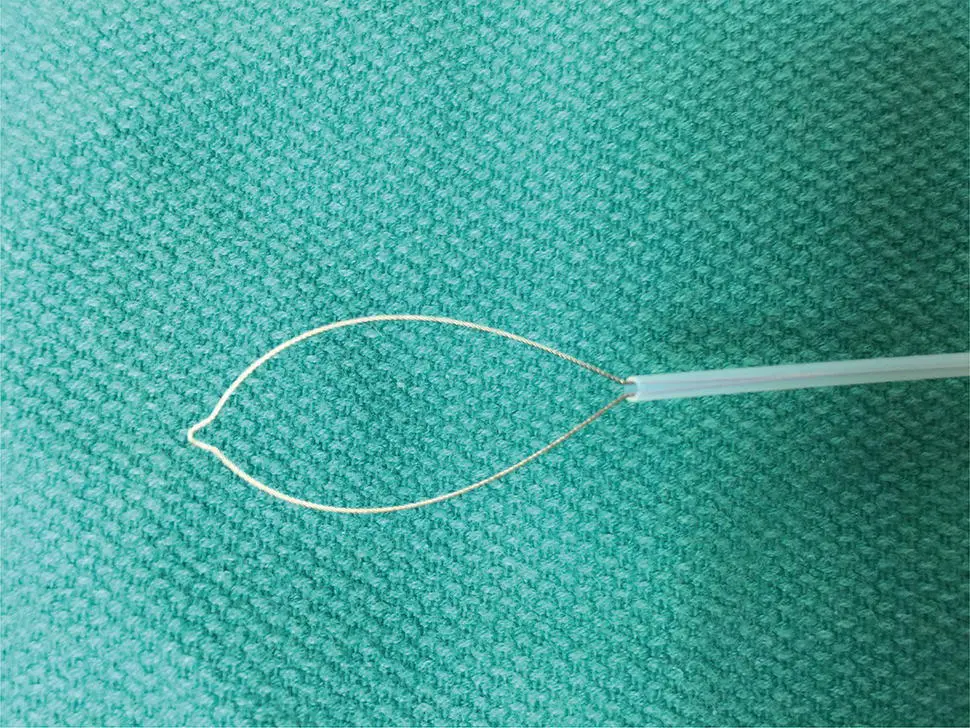 Figure 16 Endoscopic snare for polypectomy The wire loop is extended in the - фото 7