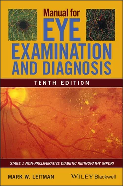 Mark W. Leitman Manual for Eye Examination and Diagnosis обложка книги