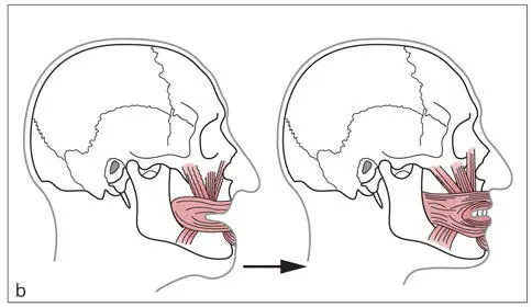 Abb 19Effekte der Augmentation bei Alveolarkammatrophie a Die - фото 20