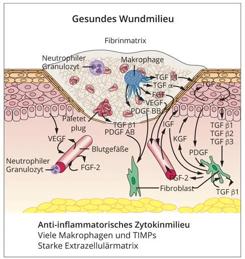 Abb 28a Das antiinflammatorische Wundmilieu einer heilenden Wunde zeichnet - фото 39