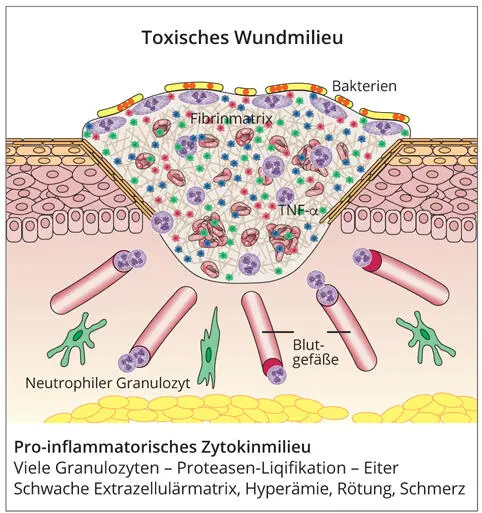 Abb 28a Das antiinflammatorische Wundmilieu einer heilenden Wunde zeichnet - фото 40