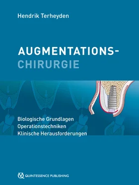 Hendrik Terheyden Augmentationschirurgie обложка книги