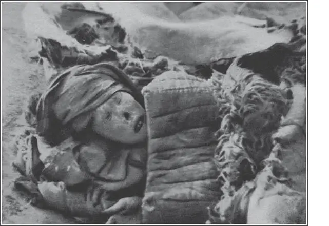 Leiche einer Leprakranken aus Kumbum Foto Wilhelm Filchner Von Lauyai - фото 21