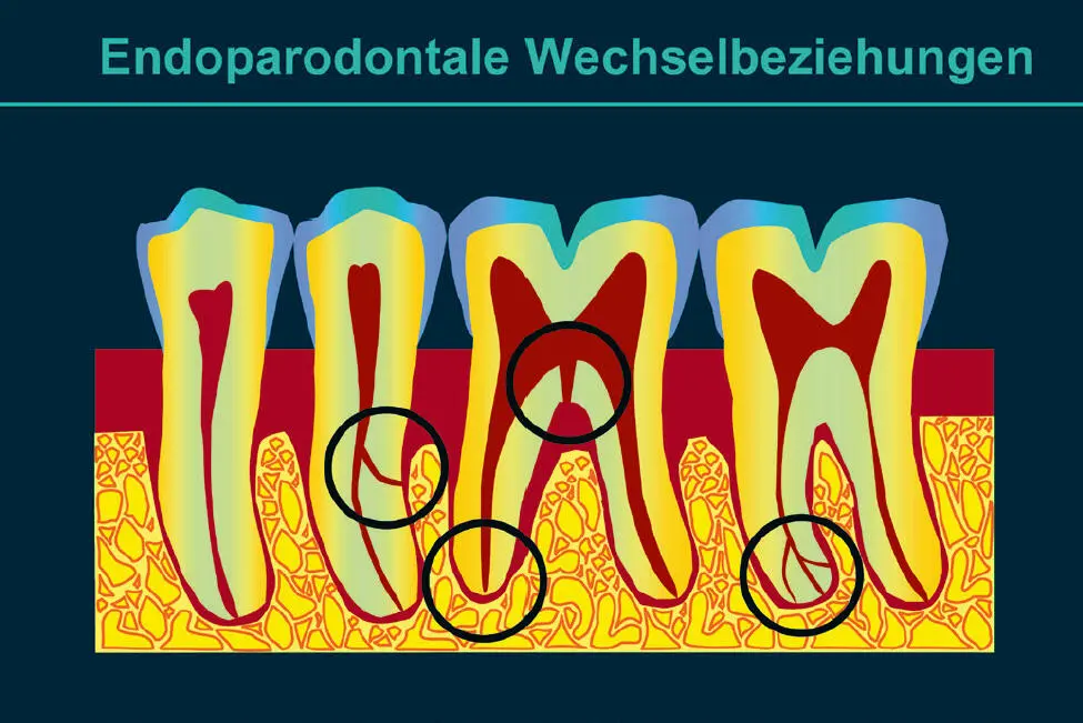 Abb 1 Endodont und Parodont liegen räumlich eng benachbart und sind nur vom - фото 58