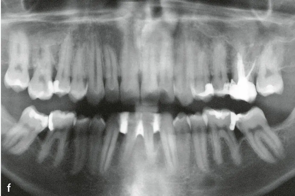 Abb1e und f e Klinische Ansicht im Alter von 22 Jahren 14 Jahre nach - фото 51