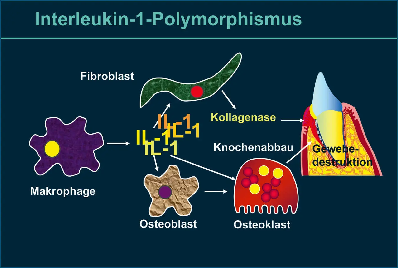 Abb 5 Interleukin1PolymorphismusGenotyp Bei einem entzündlichen Reiz z - фото 35