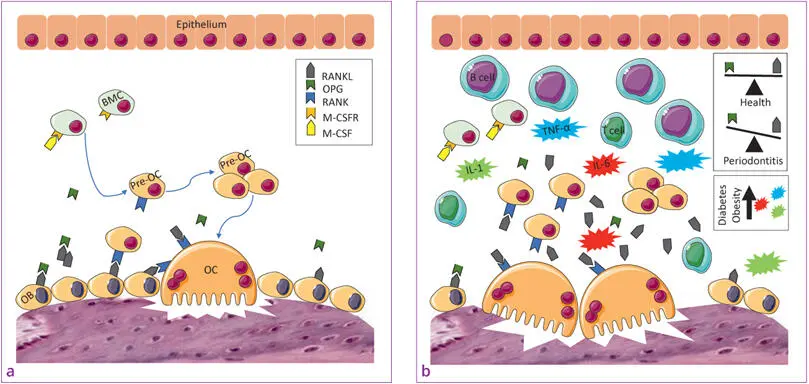 Fig 13a and b aOsteoclast differentiation and activity bPathological bone - фото 7