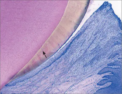 Fig 4 Higher magnification Oral sulcular epithelium and junctional epithelium - фото 8