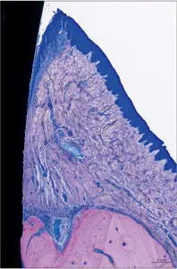 Fig 7 Higher magnification Supracrestal periimplant soft tissues consisting - фото 11