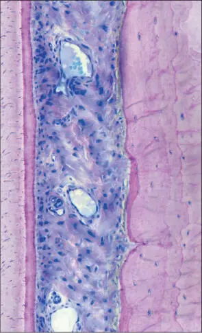 Fig 5 Higher magnification Intact periodontal ligament connecting the root - фото 9