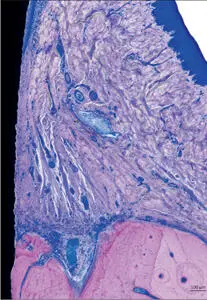 Fig 9 Higher magnification Supracrestal portion of the periimplant soft - фото 13