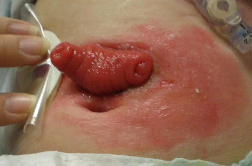 Figure 22 Irritant dermatitis Source Photo courtesy of Judith Stellar - фото 8