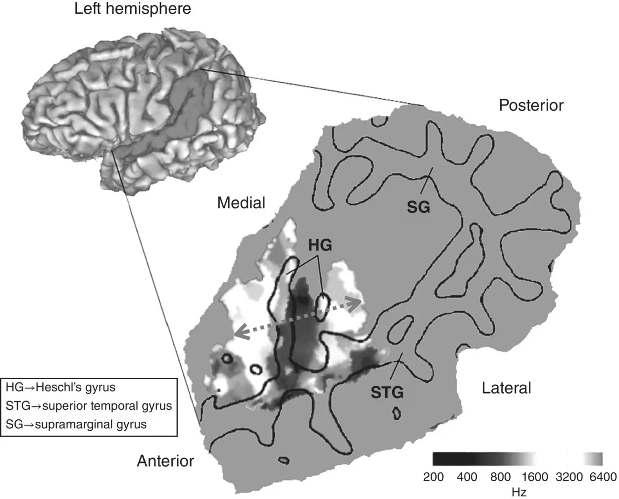 Figure 35 Tonotopic map HG Heschls gyrus STG superior temporal gyrus - фото 9