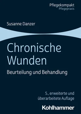 Susanne Danzer Chronische Wunden обложка книги