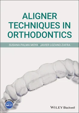 Susana Palma Moya Aligner Techniques in Orthodontics обложка книги