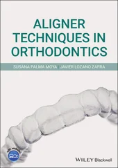 Susana Palma Moya - Aligner Techniques in Orthodontics