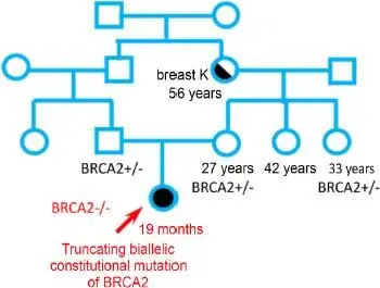 Figure 15 Fanconi disease autosomal recessive transmission Both parents are - фото 7
