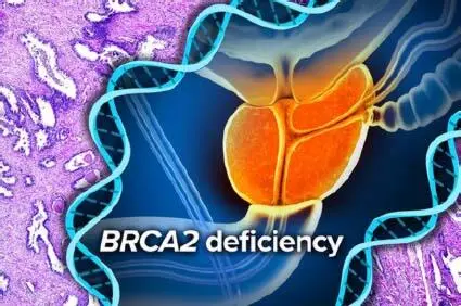 Figure 12 BRCA2 mutations are associated with breast and ovarian cancer but - фото 4