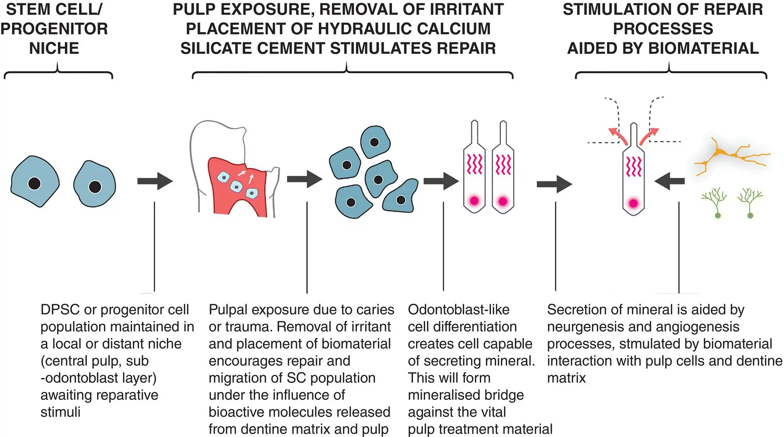 Figure 21 Schematic representation of the reparative process after pulp - фото 3