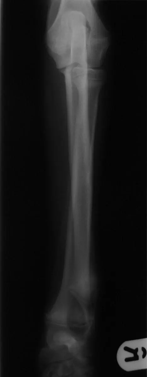 Figure 354 a normal straight leg Source Photo courtesy of Andy Moores - фото 158