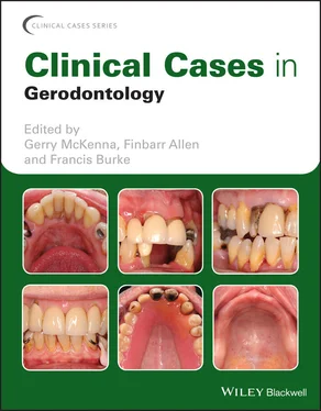 Неизвестный Автор Clinical Cases in Gerodontology обложка книги