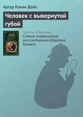 Артур Конан Дойль Человек с вывернутой губой обложка книги