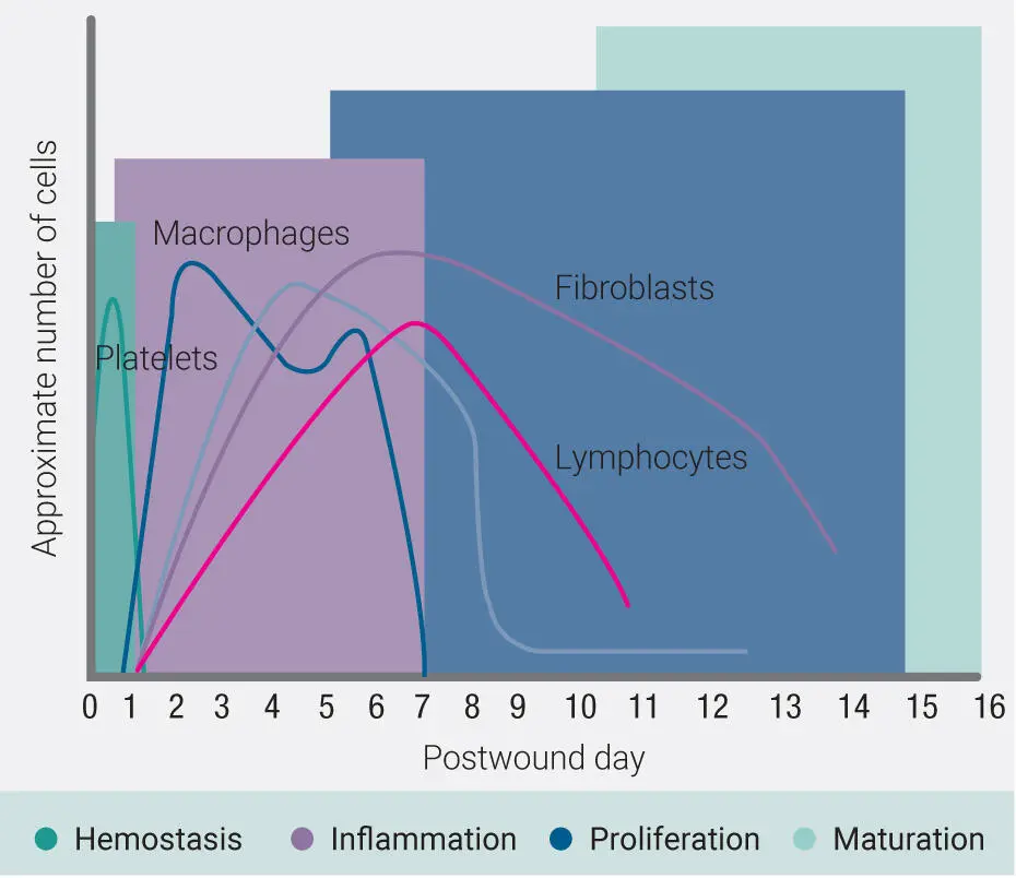 Fig 12Four phases of wound healing 1 hemostasis 2 inflammation 3 - фото 7