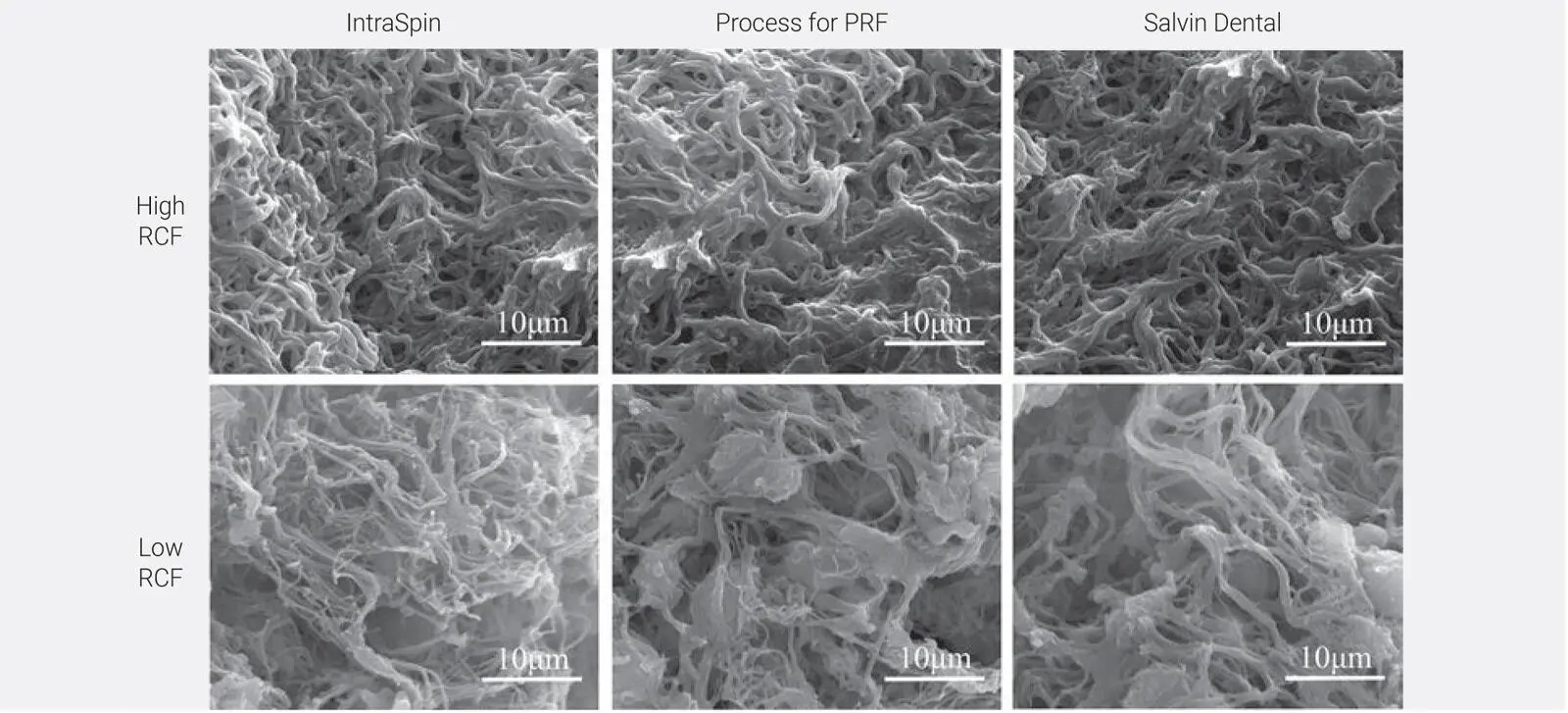 Fig 27SEM of PRF clots produced on three different devices at either - фото 29