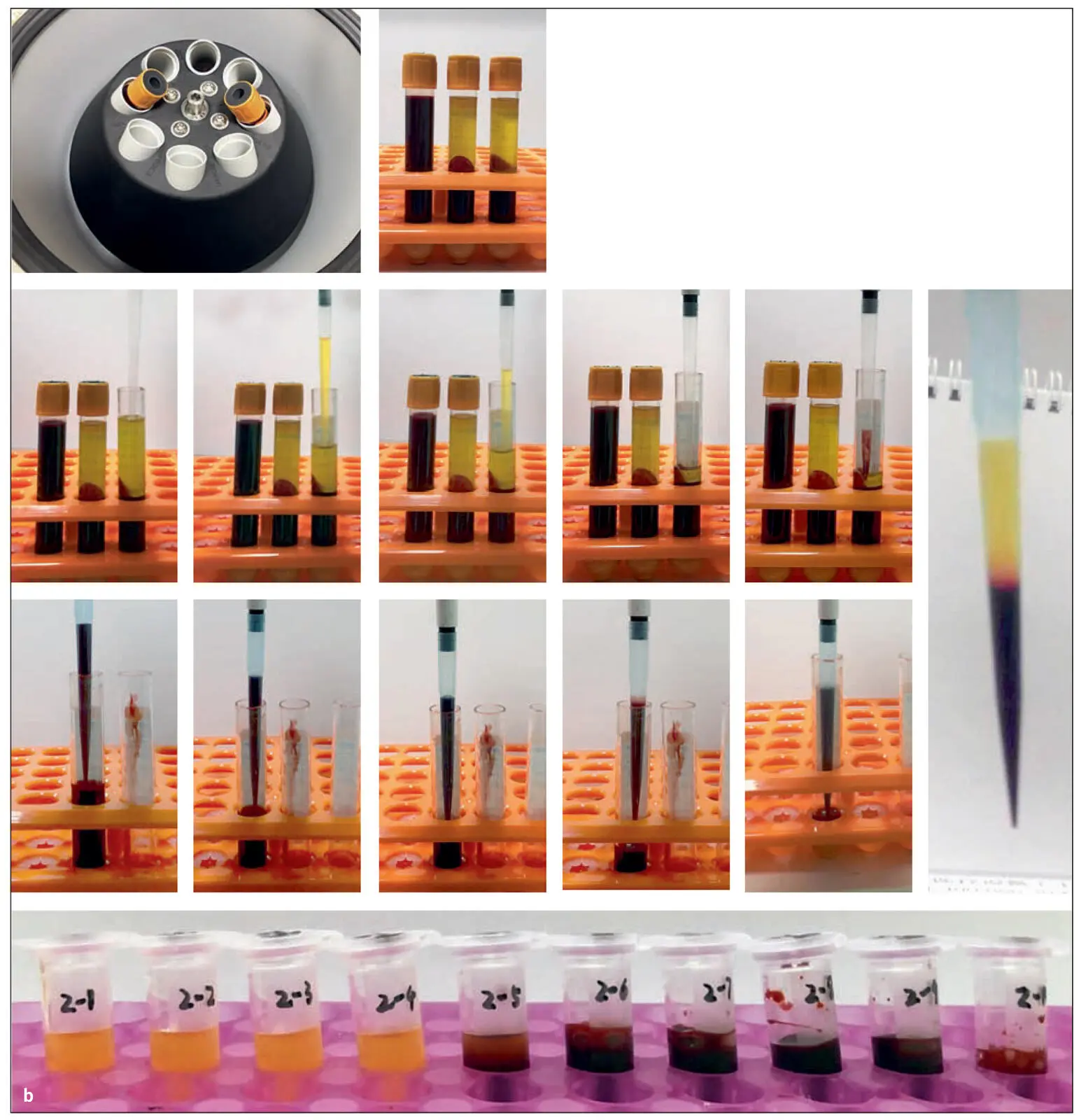 Fig 213 a Illustration demonstrating the proposed novel method to quantify - фото 36