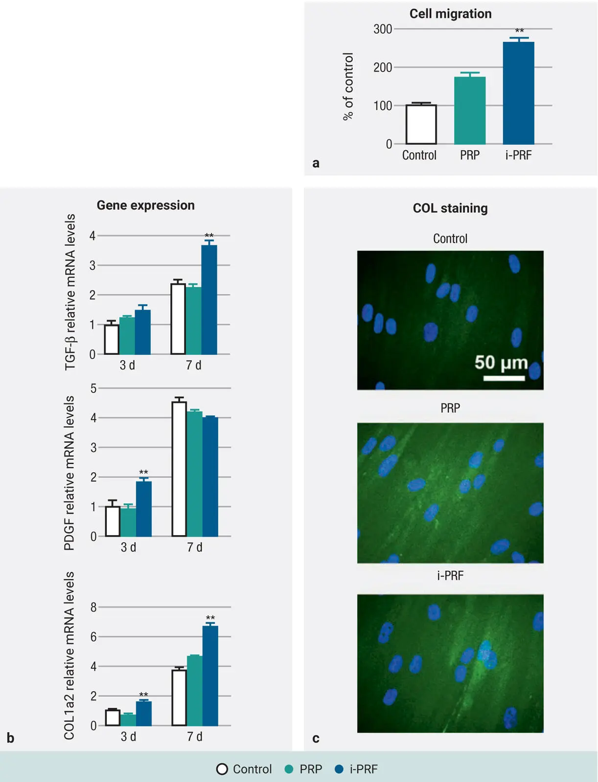 Fig 211Human gingival fibroblast behavior exposed to iPRF versus PRP a - фото 33