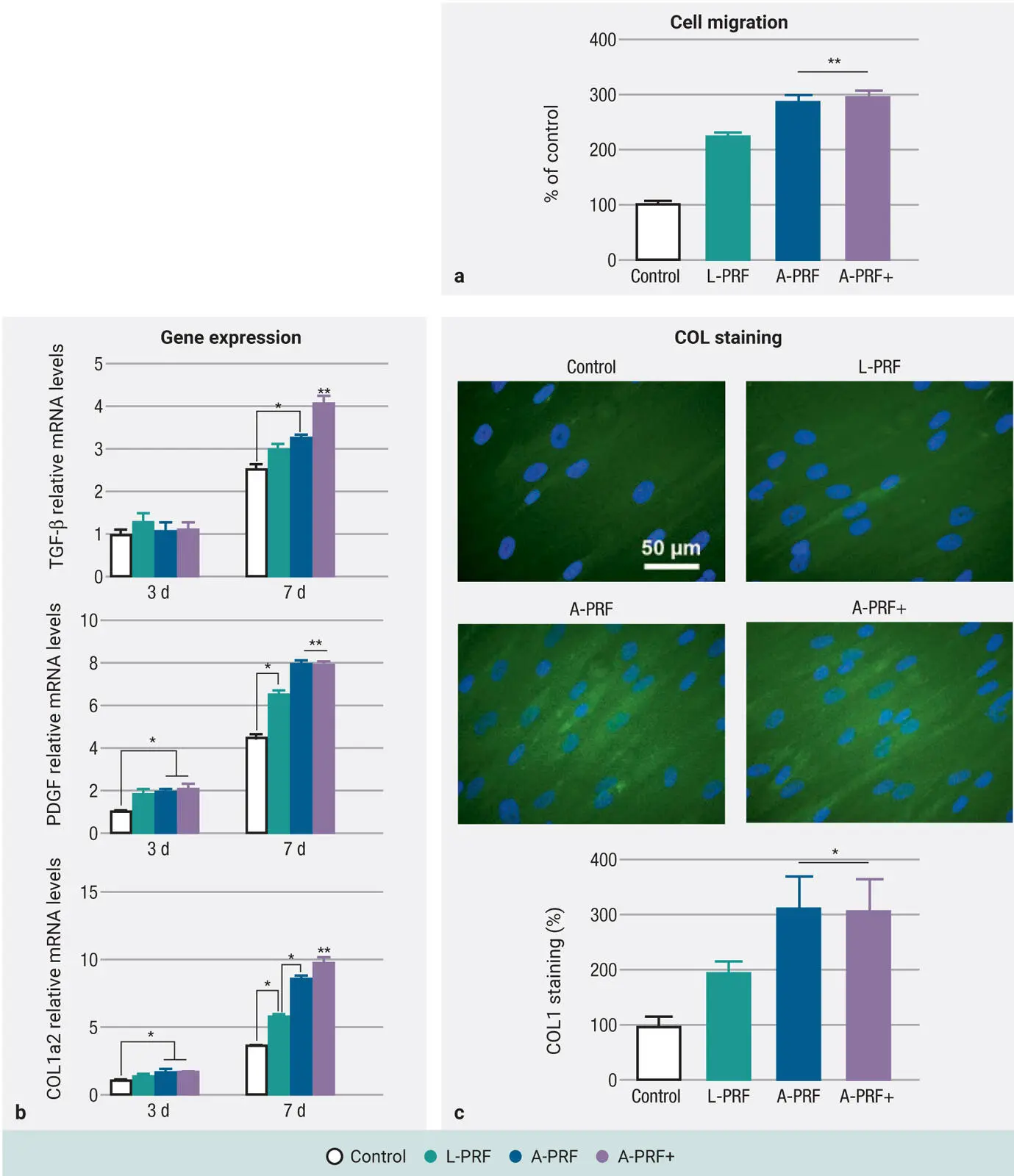 Fig 25Human gingival fibroblast behavior exposed to LPRF APRF and APRF - фото 27