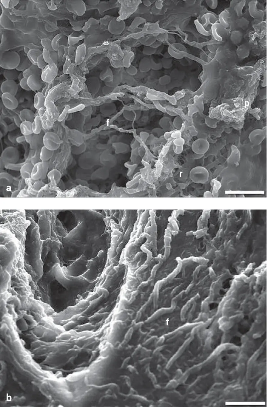 Fig 29The surface a and crosssection b microstructures of the iPRF f - фото 31