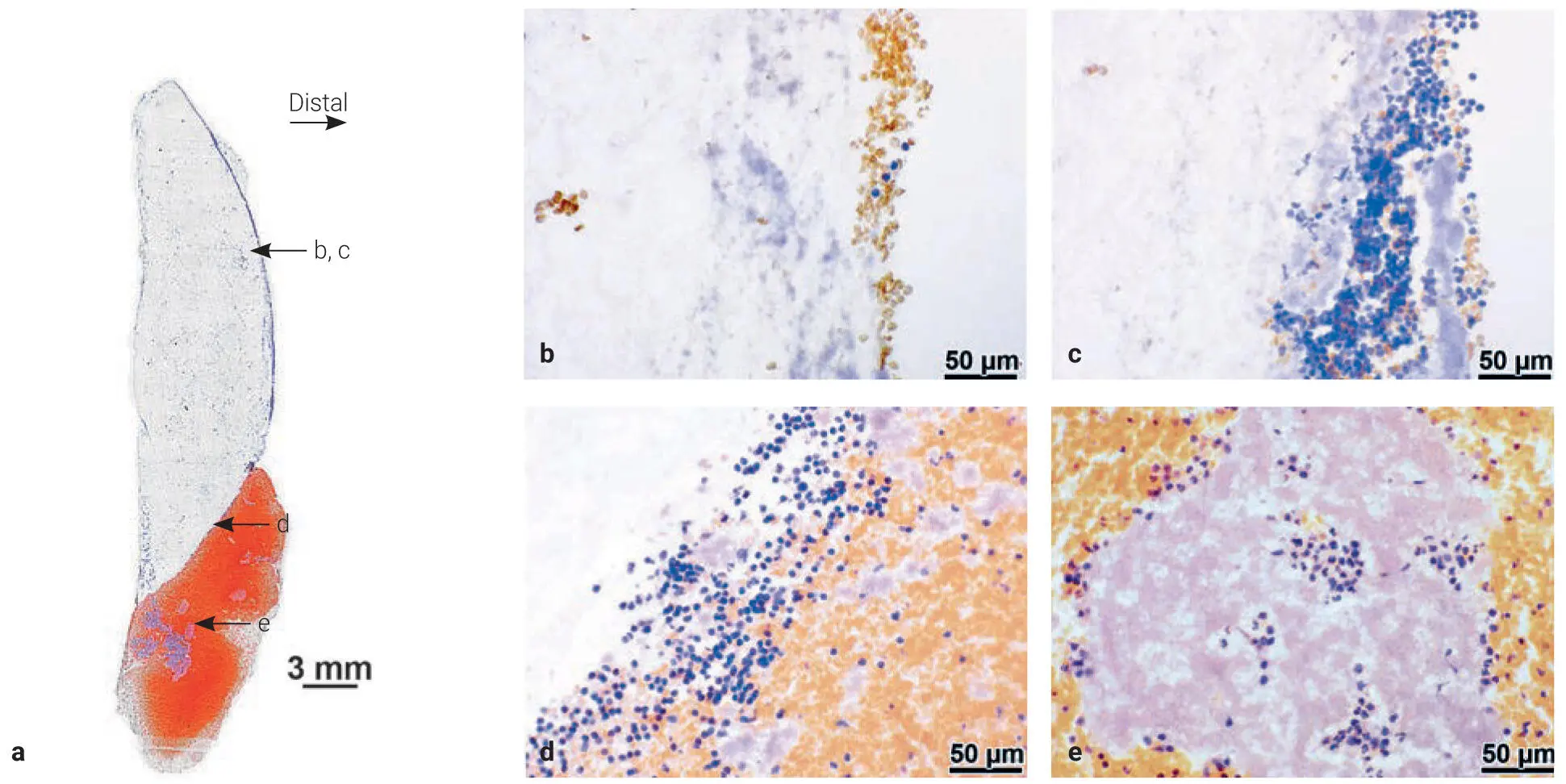 Fig 311Histologic observation of the frozen section of LPRF sectioned - фото 77