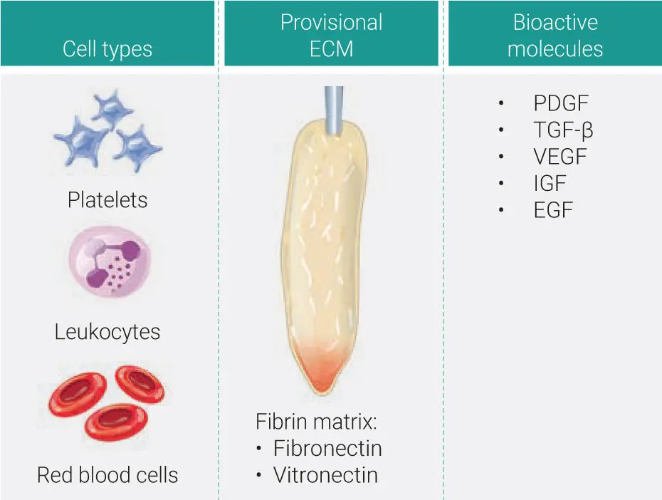 Fig 15Three main components of PRF all derived naturally from the human body - фото 10