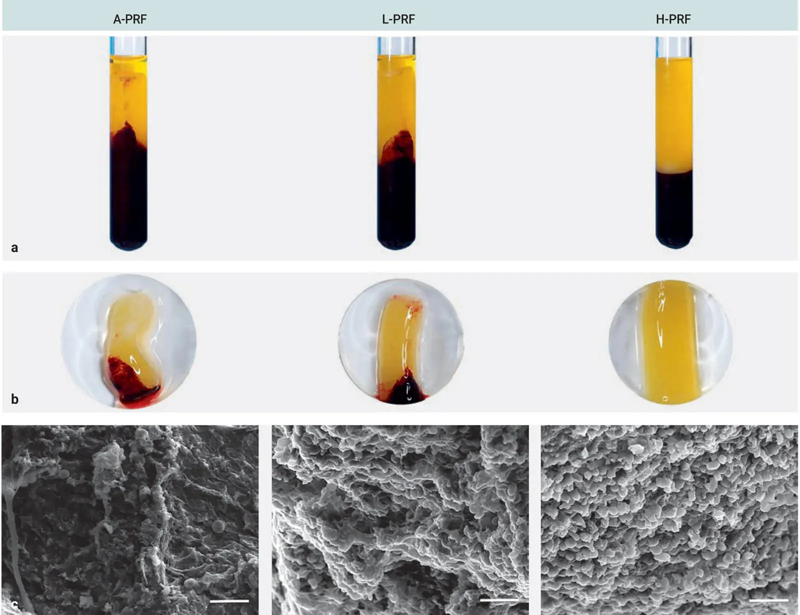 Fig 39Characterization of APRF LPRF and HPRF a and b The morphology - фото 75