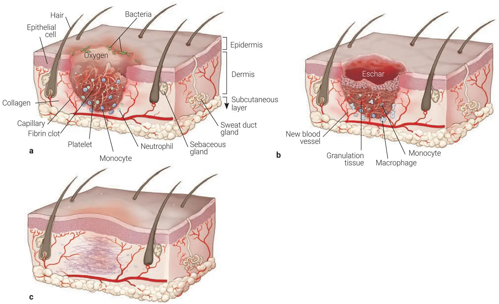 Fig 21The three stages of wound healing a Inflammatory phase b - фото 20