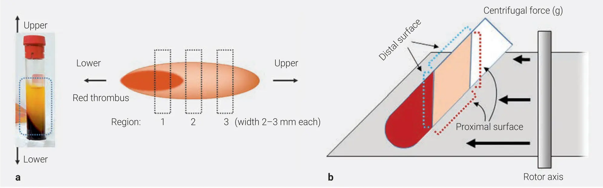 Fig 36Experimental setup describing the orientation of PRF membranes during - фото 70