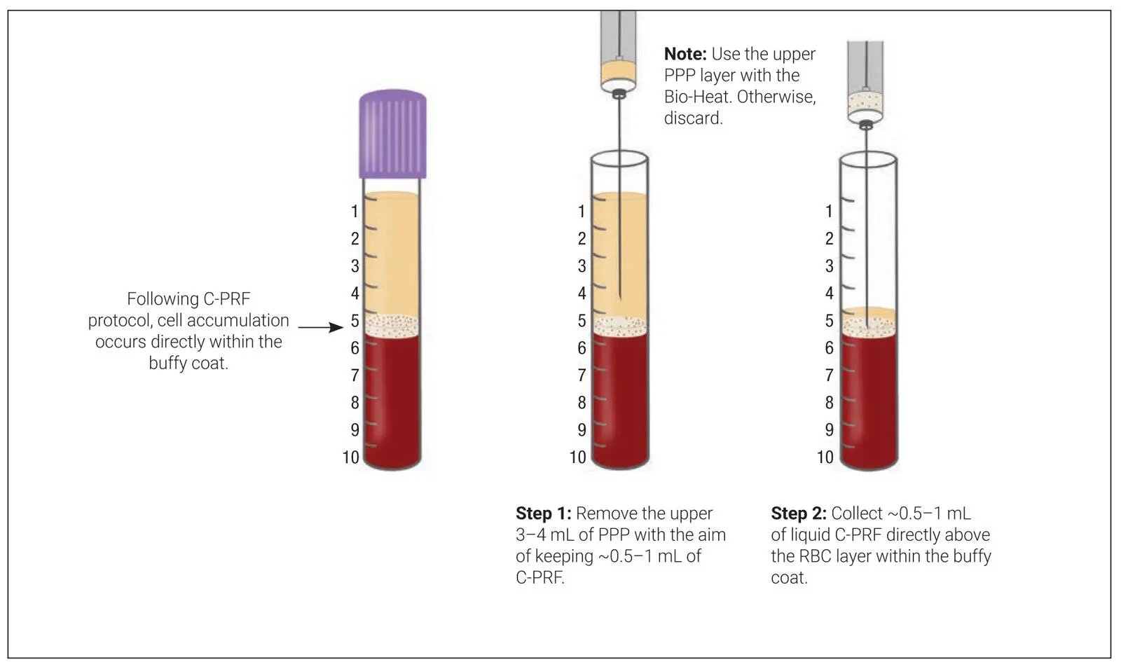 Fig 322Method to collect and concentrate CPRF Following centrifugation at - фото 88