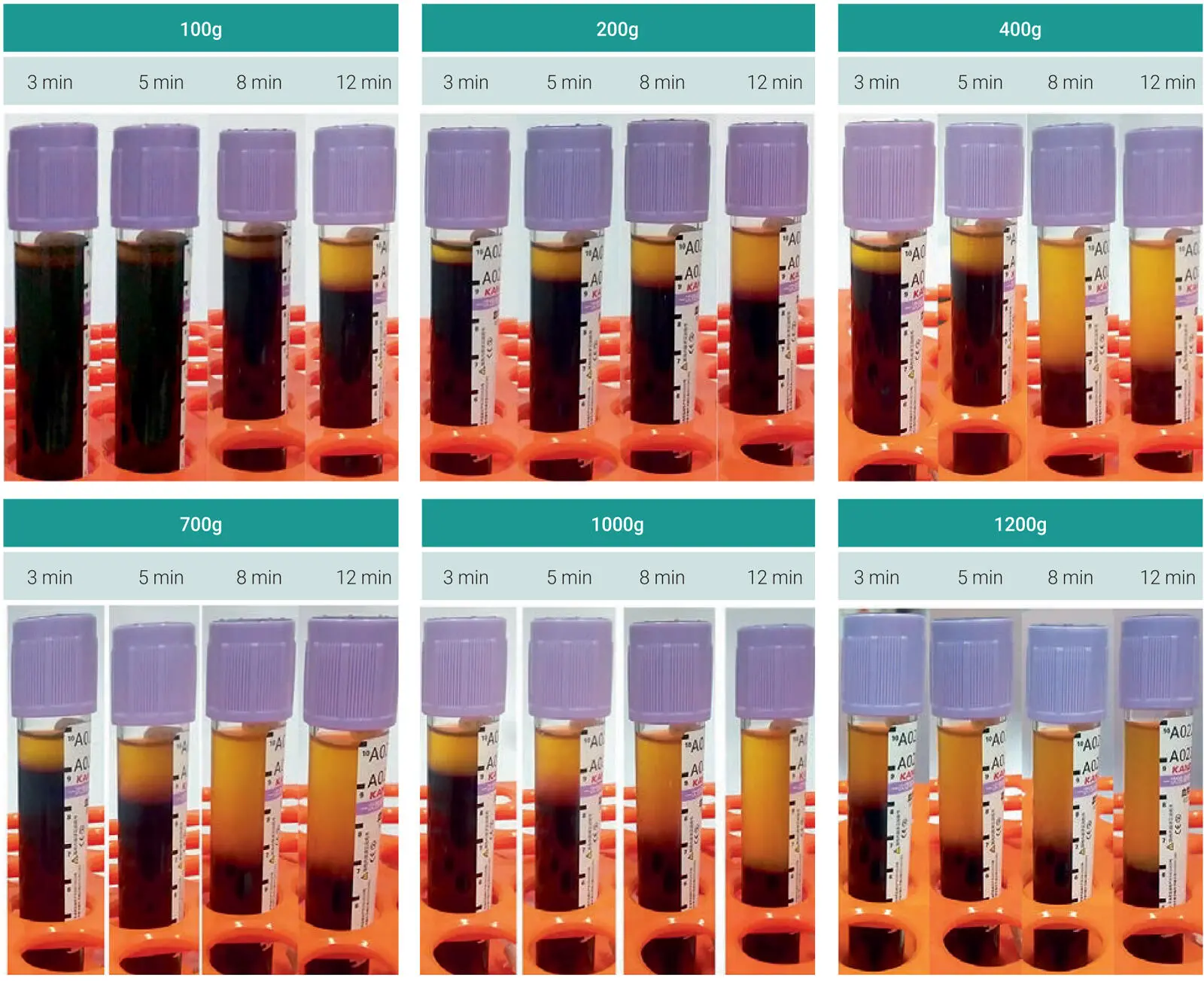 Fig 315Clinical image demonstrating the plasma layer separation for the 24 - фото 81