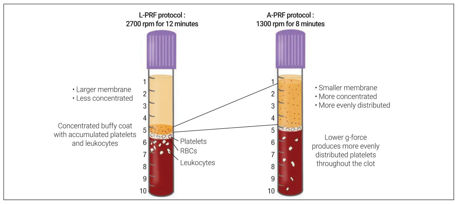 Fig 218Summary of the findings comparing LPRF and APRF protocols While - фото 42