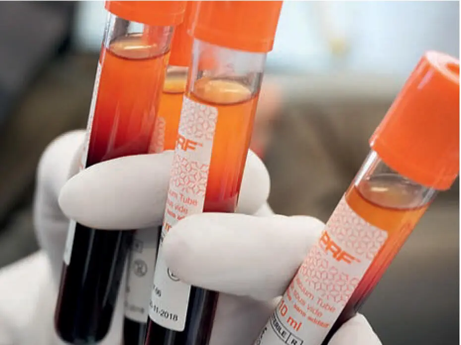 Fig 17Newer centrifugation protocols allow production of a liquid formulation - фото 12