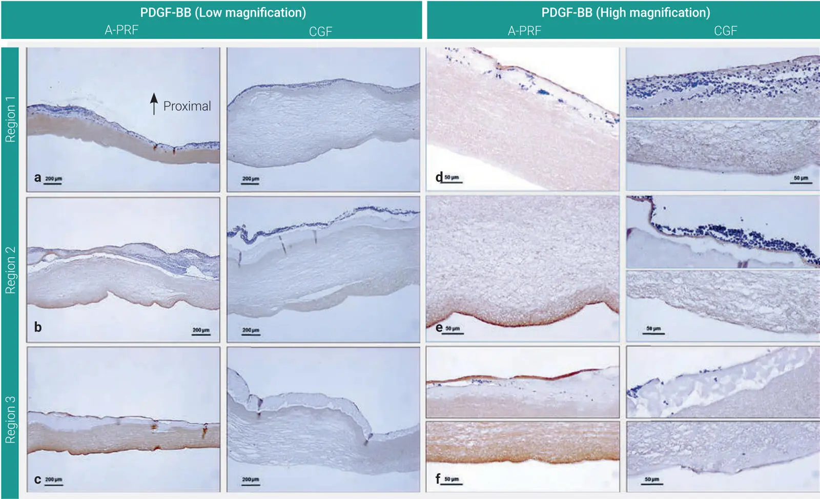 Fig 37Distribution of PDGFBB in APRF and CGF matrices a and d Region 1 - фото 71