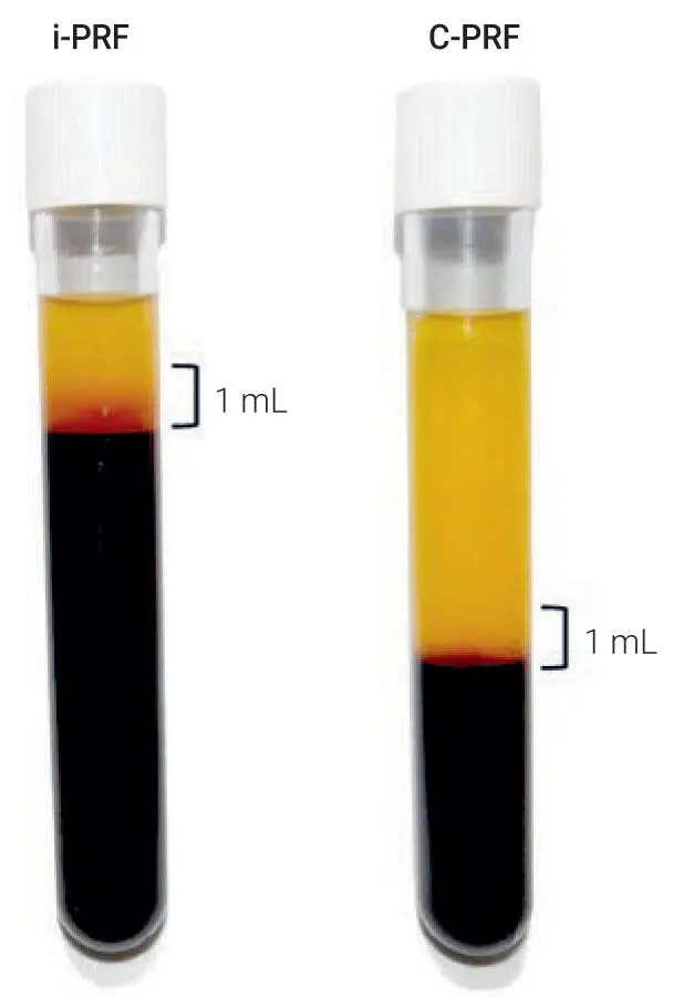 Fig 320Visual representation of layer separation following either the iPRF - фото 86