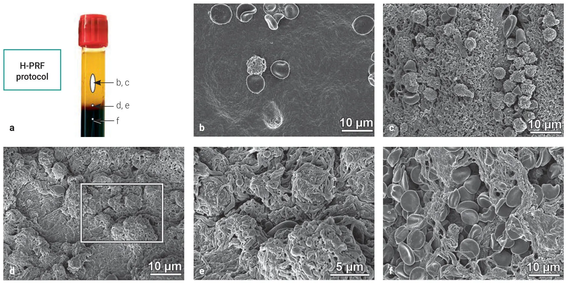 Fig 312SEM images of the distal surface of PRF clots prepared utilizing the - фото 78