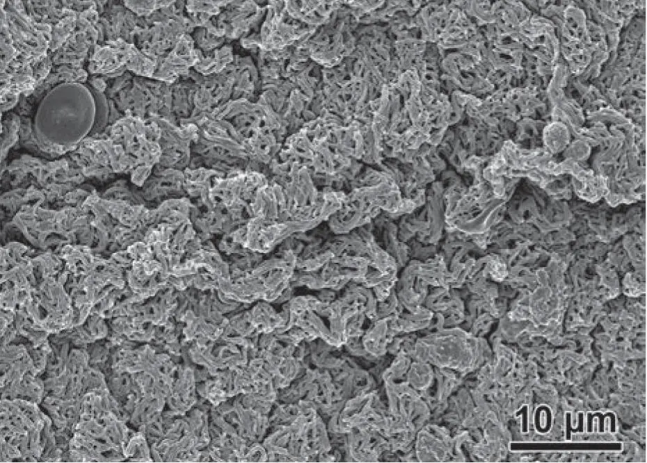 Fig 22SEM examination of the fibrin clot revealing a dense and mature fibrin - фото 24